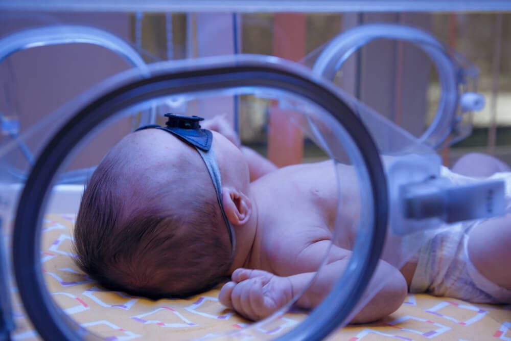 Cerebral Palsy Related Conditions Birth Disorders